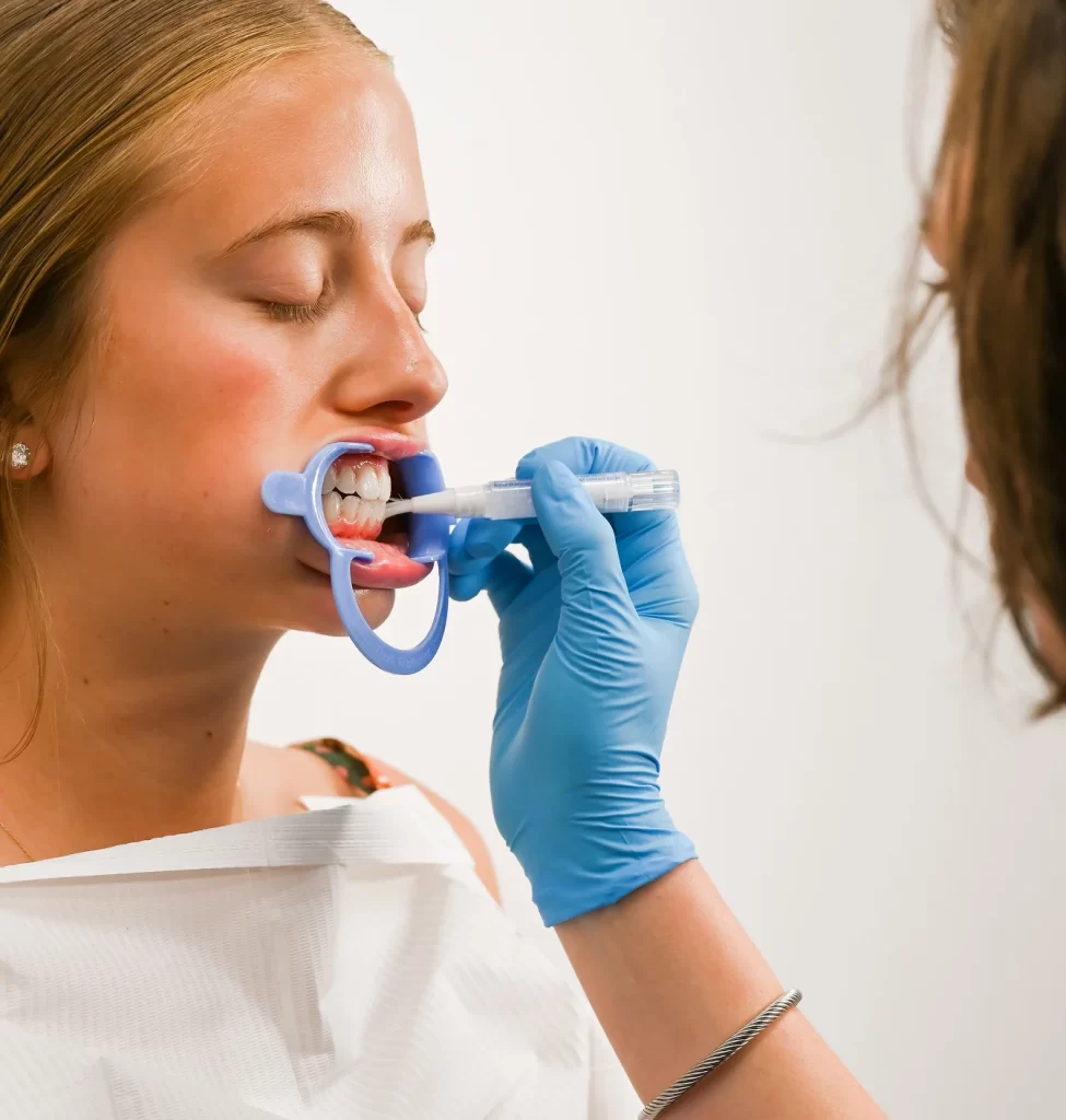 Client receiving DaVinci teeth whitening treatment