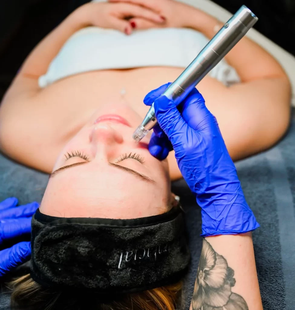 Provider performing microneedling on a client's forehead