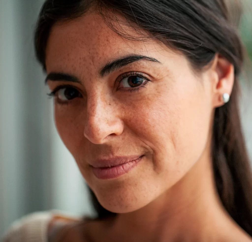 Close-up portrait of a woman with freckles and uneven skin texture